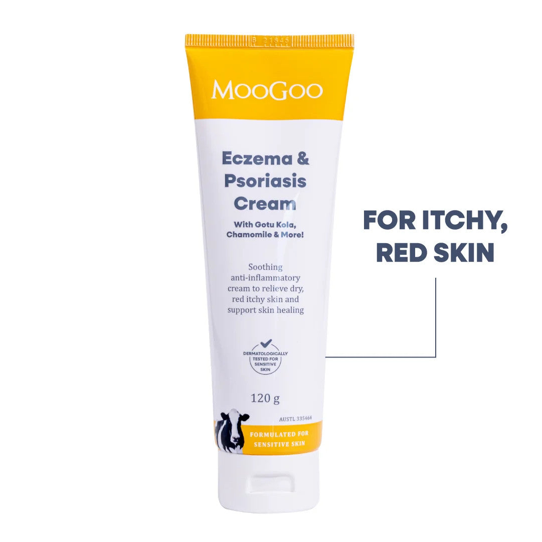 A tube of Eczema & Psoriasis Cream on a white back ground. 