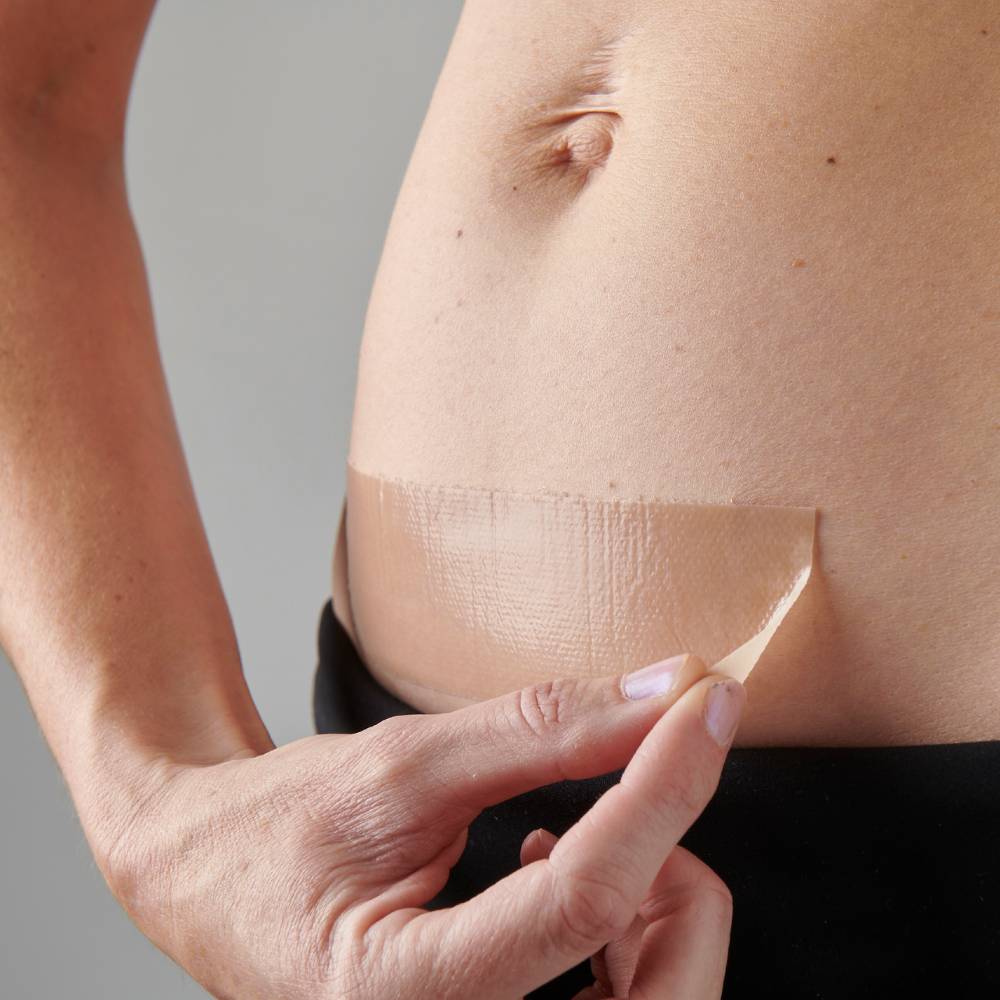 The Active Caesarean Silicone Strips